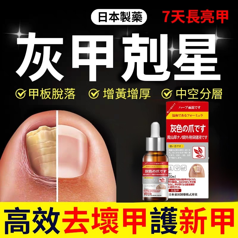 灰指甲的救星，灰甲抑菌滴液！ 恢復指甲健康，有效解決灰指甲、甲溝炎問題，讓指甲7天重獲新生，就是這麼簡單！